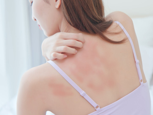 Role kožního mikrobiomu v patogenezi atopické dermatitidy