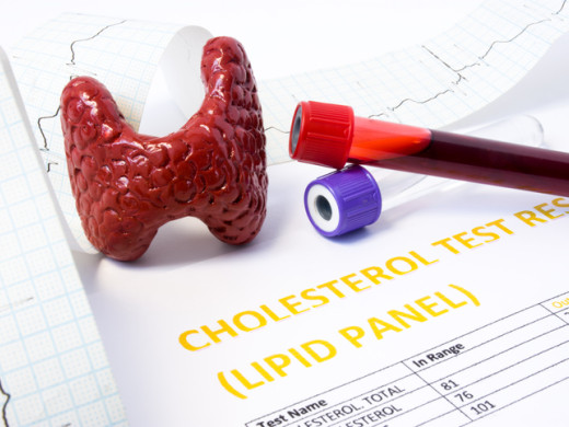 Hypocholesterolemie – máme se z ní radovat, nebo se jí obávat?