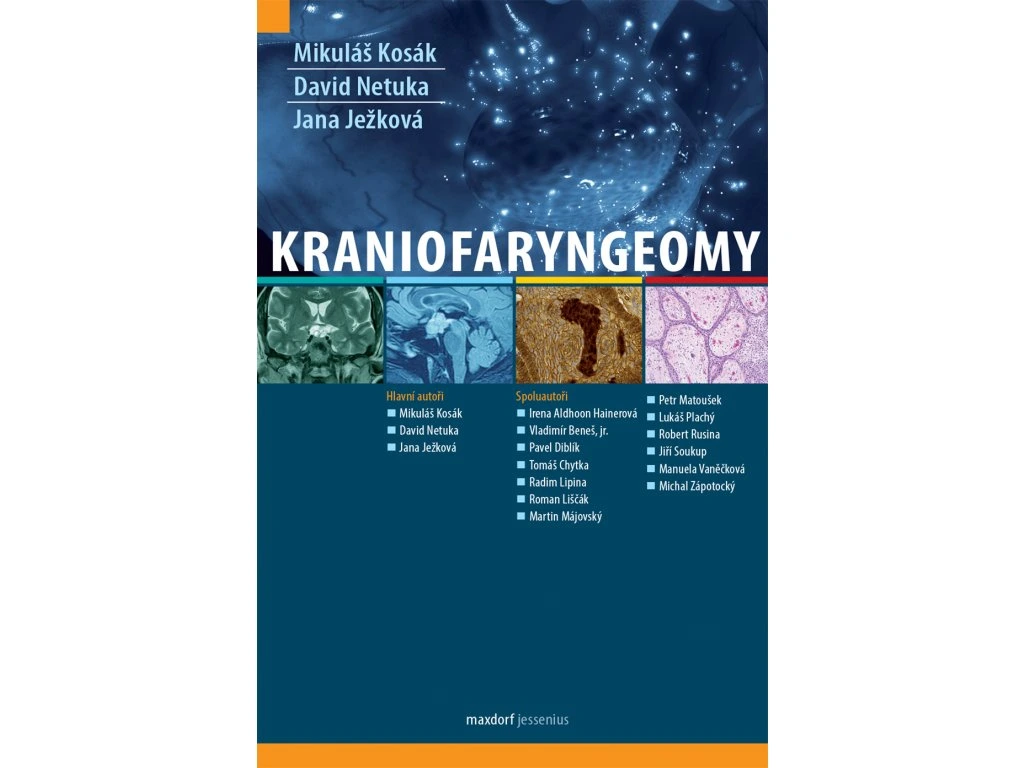 Kraniofaryngeomy